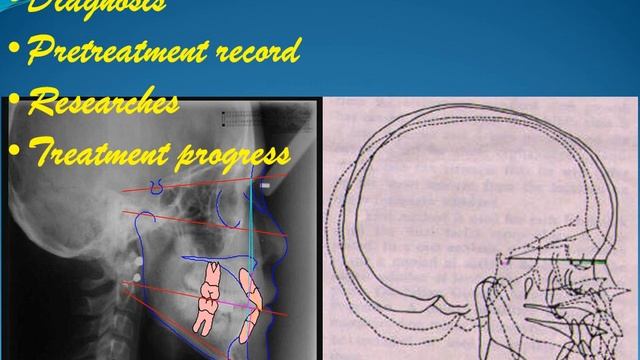 Orthodontic records#dr.kasem ahmed смотреть онлайн