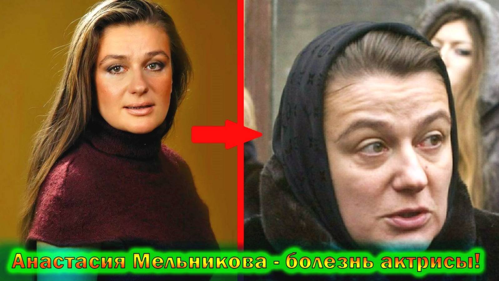 Анастасия Мельникова - чуть не стала инвалидом, неизвестная болезнь актрисы и не простая судьба! смотреть онлайн