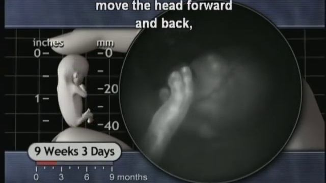 Window on the Womb: 8 to 11 Weeks смотреть онлайн