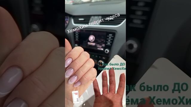 Хемохим творит чудеса 😎😍