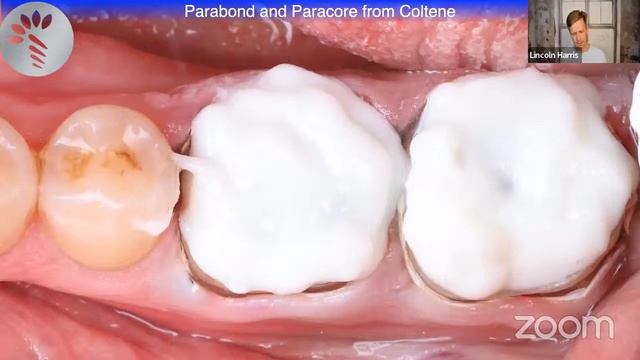 Dental Nachos Presents: Fast Easy Crown Preps a CE on TV event with Dr. Lincoln Harris смотреть онлайн