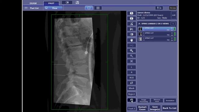 Canon NE Software Overview смотреть онлайн