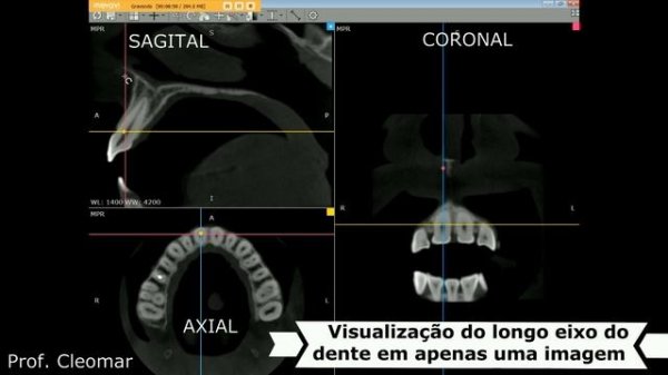 RadiAnt Dicom Viewer -Tutorial para Dentistas