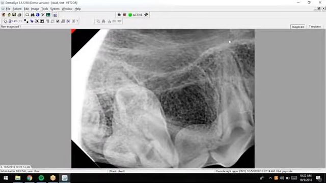 DentalEye Software Demo смотреть онлайн