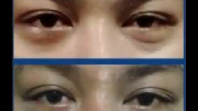 Kizoa Online Movie Maker: NWorld Nlighten Eye Gel смотреть онлайн