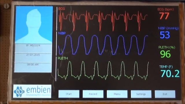 WinCE on Cubieboard2 - Medical Application Demo смотреть онлайн