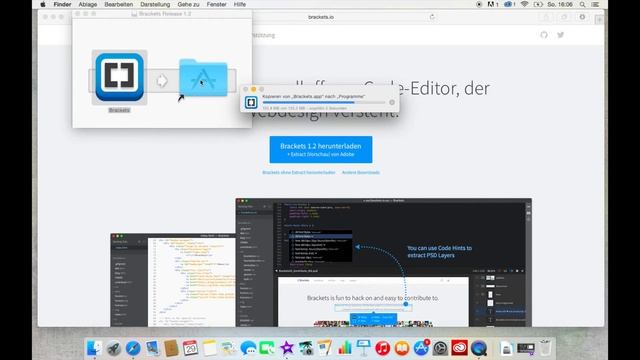 Wie installiere ich Brackets? - #onkomm смотреть онлайн