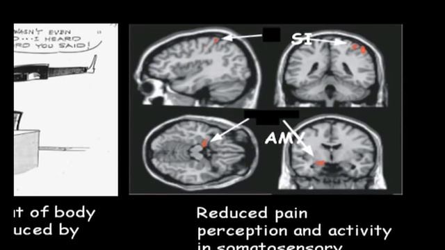Dr David Linden - Brain research in psychiatry: A new window into the mind. смотреть онлайн