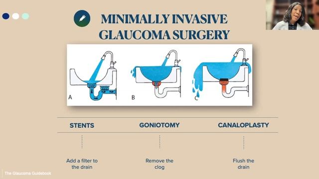 Shining Light on Glaucoma: Expert Tips to Prevent Blindness (Webinar) смотреть онлайн
