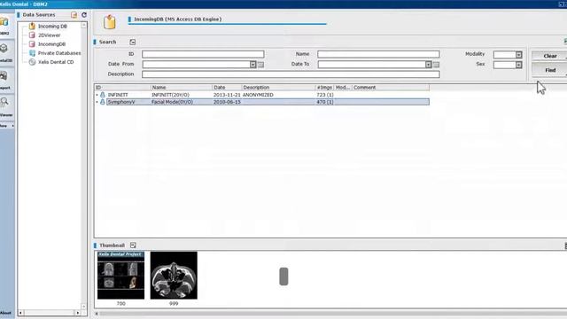 Xelis Dental Load ProjectFile