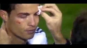 Криштиану Роналду разбили бровь до крови