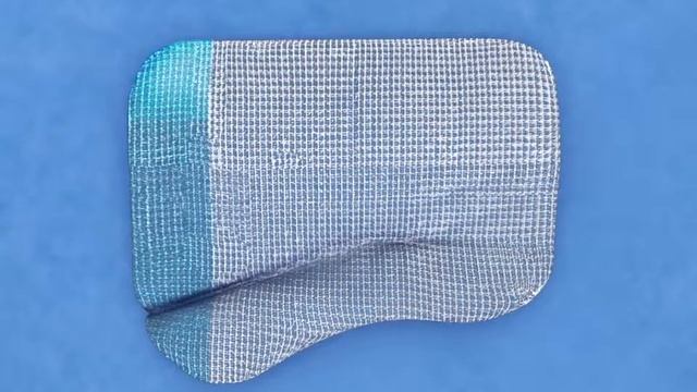 ProGrip™ Laparoscopic Self Fixating Mesh Overview