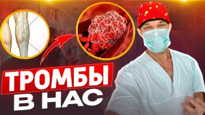 ТРОМБЫ в наших сосудах, варикоз, бляшки и тромбозы.