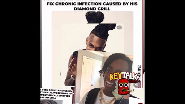 YNW Melly CHRONIC MOUTH INFECTION NOT enough 4 temp RELEASE, FUNKY BREATHE & HEALTH DECAY b/c GRILL смотреть онлайн