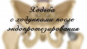 Ходьба с ходунками после эндопротезирования