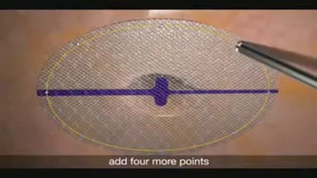 Video PM SS ANIMATION V1