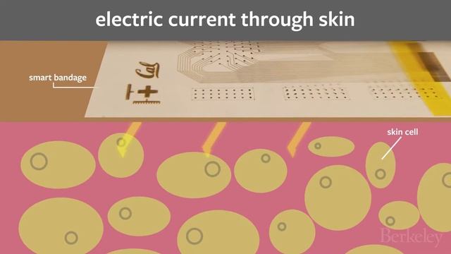 Smart bandage can help diagnose bedsores смотреть онлайн