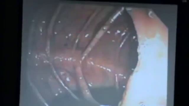 Ольга Бутакова очистка организма залог здоровья Программа 2 Коло-Вада Плюс смотреть онлайн