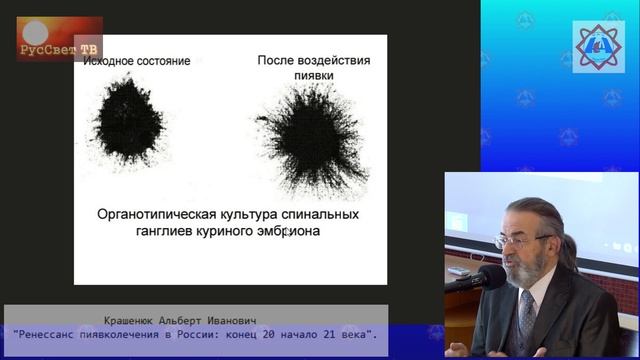 Крашенюк Альберт Иванович "Ренессанс пиявколечения в России: конец XX - начало XXI века". смотреть онлайн