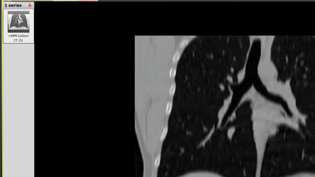 Using Ginkgo CADx To Open DICOM Files On Linux Mint From Terminal