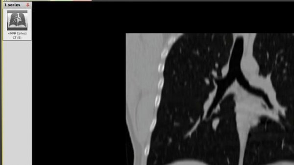 using Ginkgo CADx to open DICOM files on Linux Mint from terminal