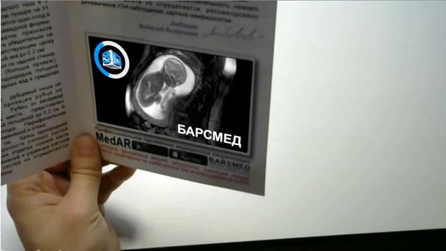 Медицинское заключения МРТ плода с дополненной реальностью сети медицинских центров "БАРСМЕД" . смотреть онлайн
