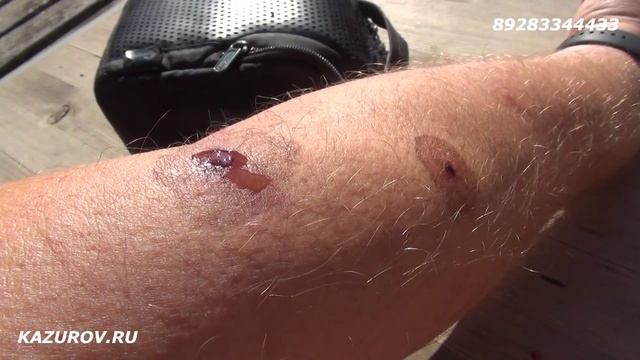 как убить грибок или окопный антисетик смотреть онлайн