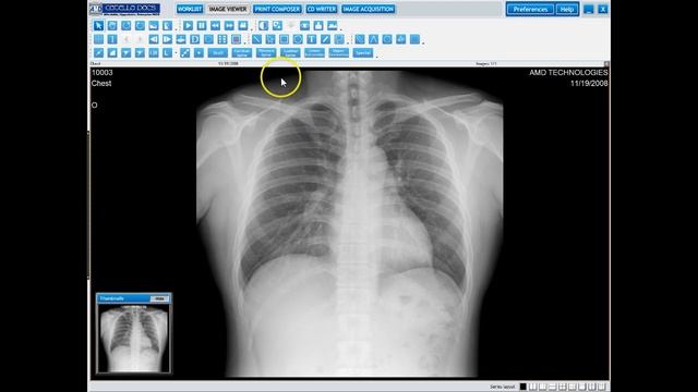 Catella 5.0 PACS - Image Viewer Screen Instructions смотреть онлайн