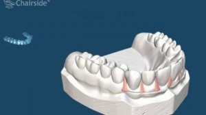 3  Принцип работы элайнеров