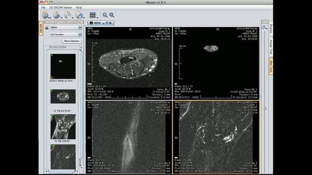 Weasis: a DICOM web viewer - 2 x 2 viewing смотреть онлайн
