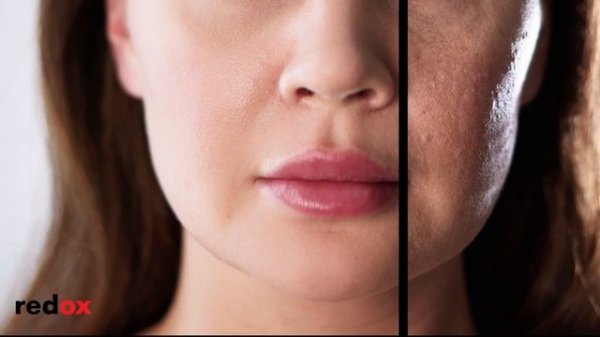 До и после - альгинатные маски redox