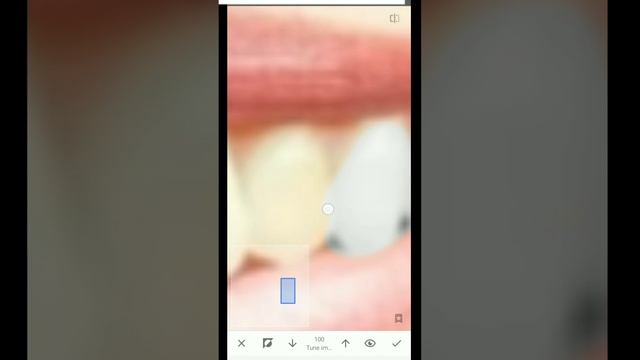 how to make teeth white in snapseed смотреть онлайн