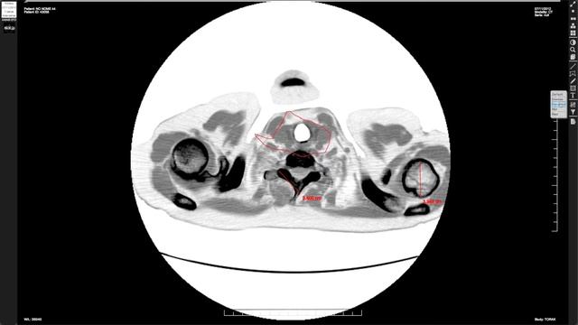 PACScenter - Web DICOM Viewer смотреть онлайн
