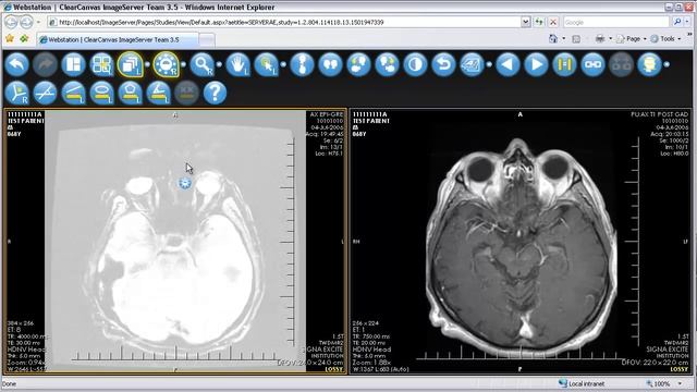 ClearCanvas PACS, Team Edition смотреть онлайн