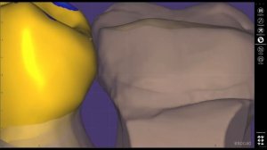 EXO CAD 24; 26 п.анатомия