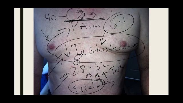 Convert Patients to DABCI Model Diagnosing Diabetes A Case Presentation смотреть онлайн
