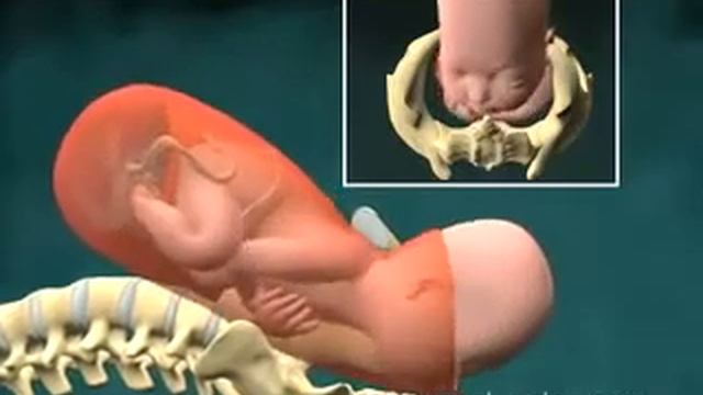 Роды. Видео. Механизм