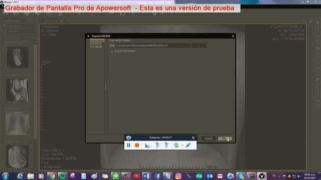 Programa WEASIS para el estudio y análisis de Metadatos смотреть онлайн