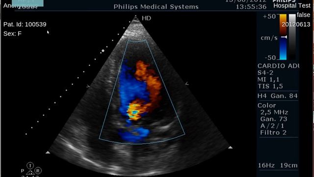 Viewing a cardiac ultrasound doppler (Dicom multiframe) on medview смотреть онлайн