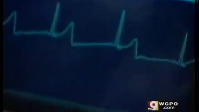 iPhone Heart Monitor смотреть онлайн