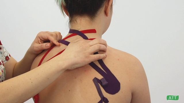 0-5_Способы снятия аппликации с кожи смотреть онлайн