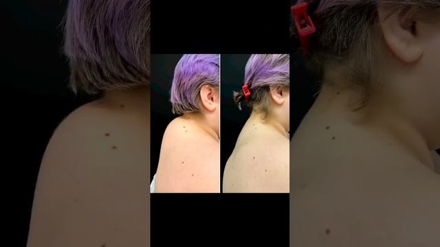 #вдовийгорб или #липосакцияхолки