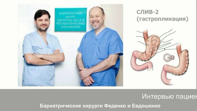 СЛИВ 2, интересная история смотреть онлайн