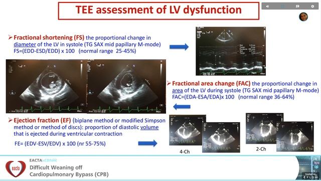 Weaning off CPB and the role of Echocardiography, Blanca Martinez (Italy) смотреть онлайн