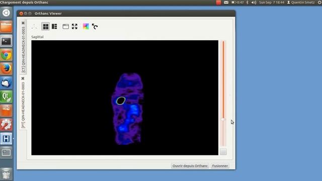 orthanc-viewer demo смотреть онлайн