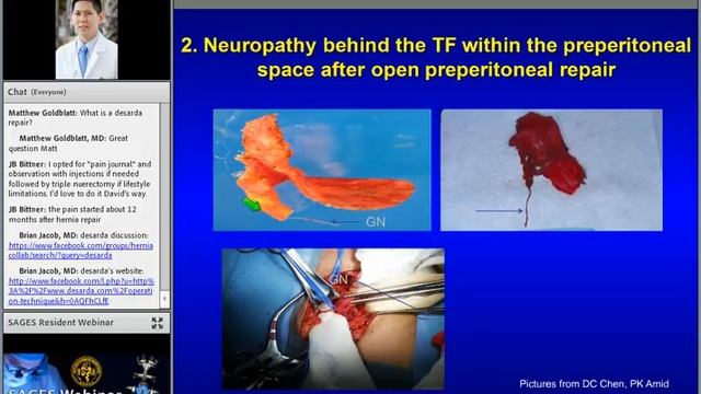 SAGES Resident Webinar: Optimizing Outcomes for Inguinal Hernia Repair смотреть онлайн