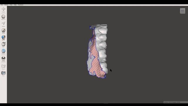 How to Prepare 3D IOS Scans To 3D Print Diagnostic and Appliance Models in Meshmixer смотреть онлайн