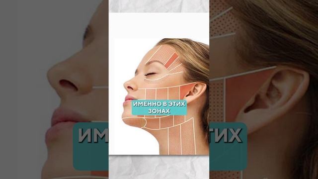 Эффект от процедуры смас-лифтинга! #кожа #процедуры #косметология смотреть онлайн