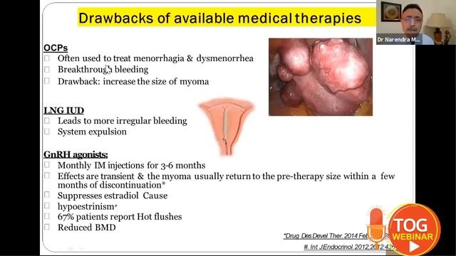 Non Invasive Therapy Of Managing Fibroids TOG Webinar || 22.04.2020 || Science Integra смотреть онлайн