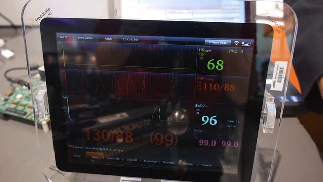 Freescale i.MX 6SoloX ARM Cortex-A9 with ARM Cortex-M4 and the Mentor Embedded Multicore Framework смотреть онлайн